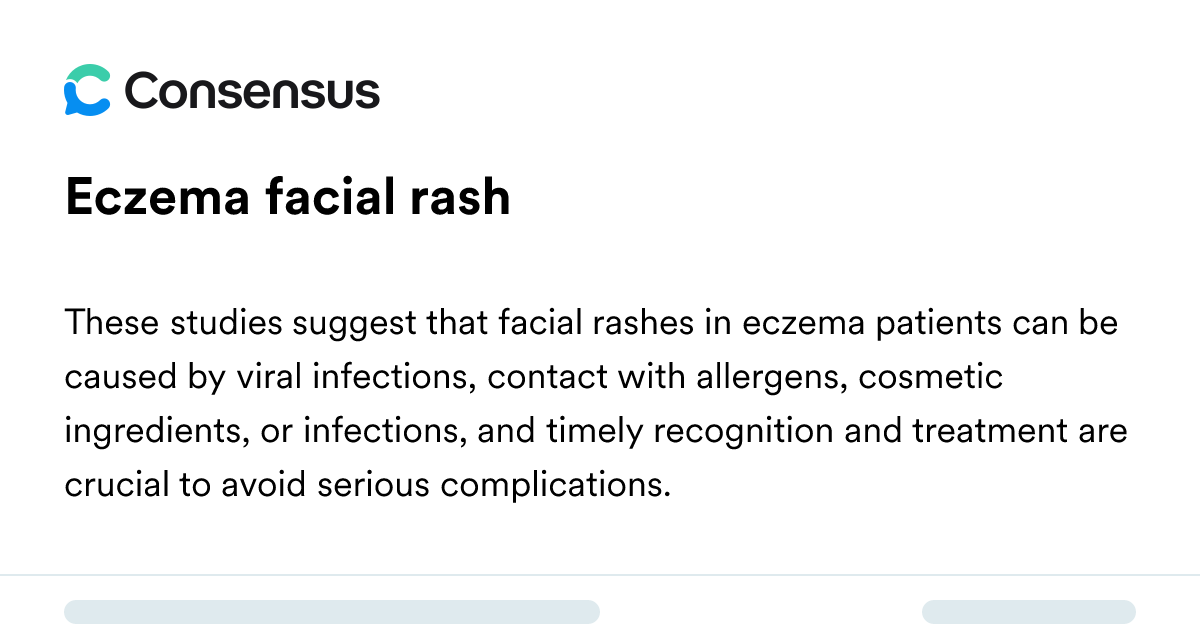 Eczema Facial Rash - Consensus Academic Search Engine