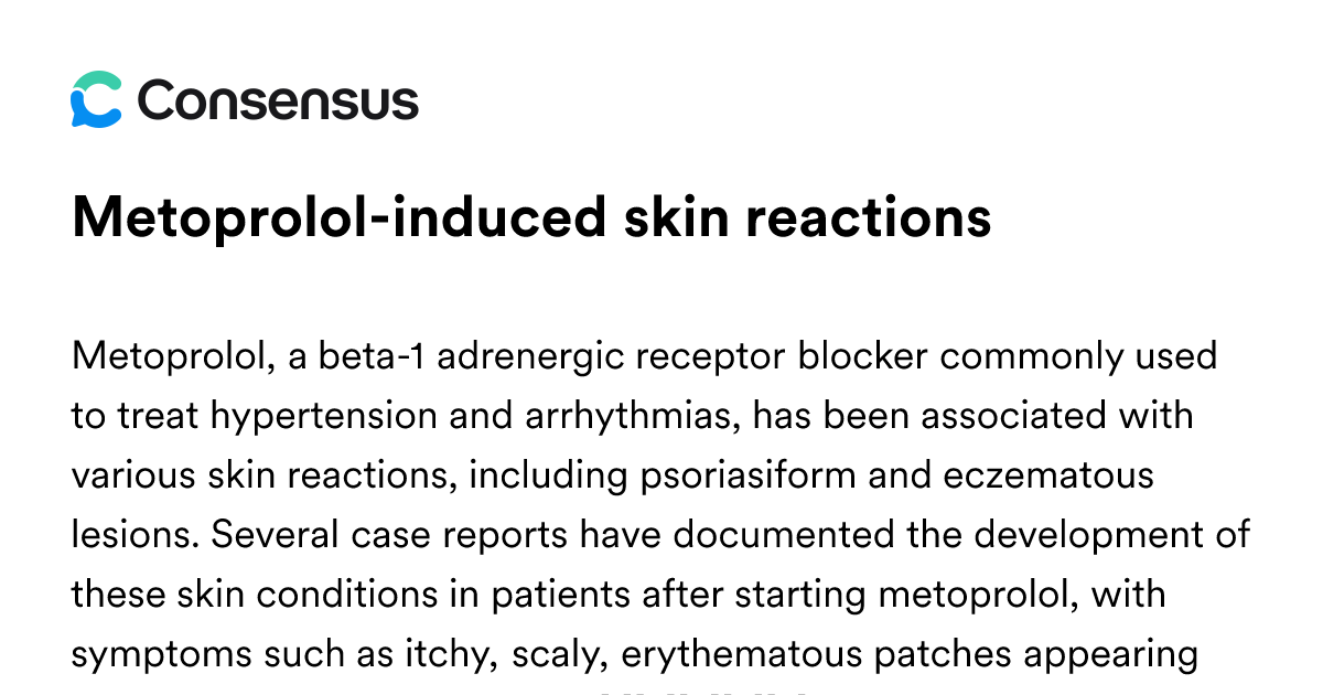 Metoprolol-induced Skin Reactions - Consensus Academic Search Engine